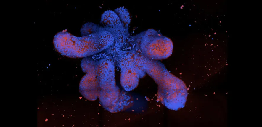 Social sharing card for £20m Cambridge hub will use stem cells and AI to make early medicines research more human